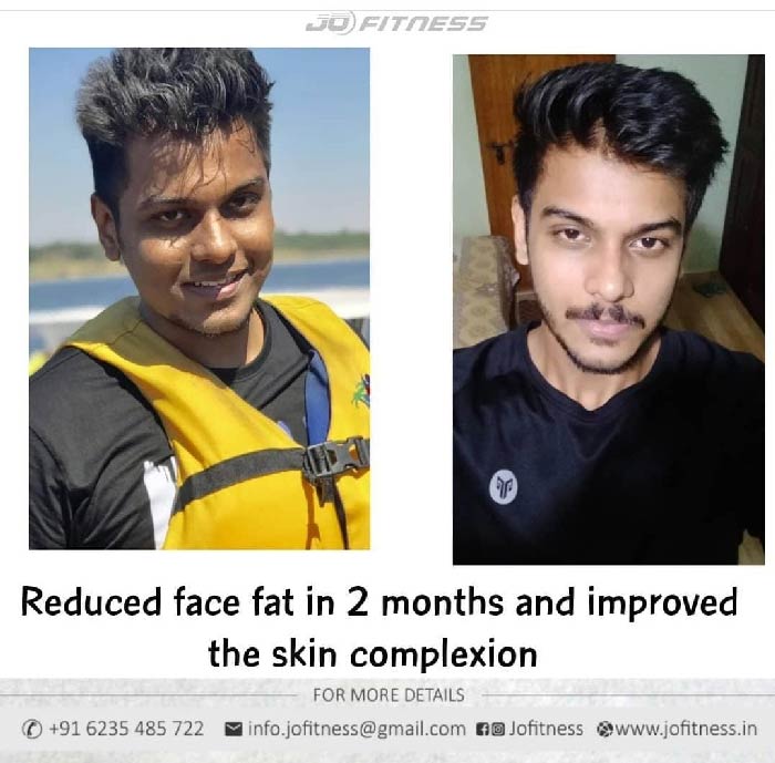 Reduced face fat in 2 months
